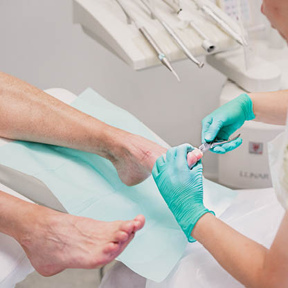 Pedicure